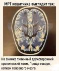 Прикрепленное изображение: МРТ кошатника.jpg